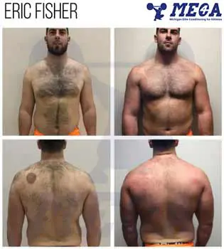 the results of a man's chest before and after surgery